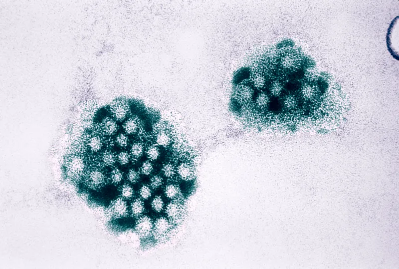 Stomach Bug Spreading Rapidly in the Northeast: CDC