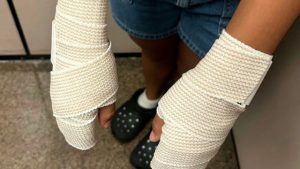 Texas Middle School Cheerleaders Sustain First and Second-Degree Burns After 'Punishment' from Coach