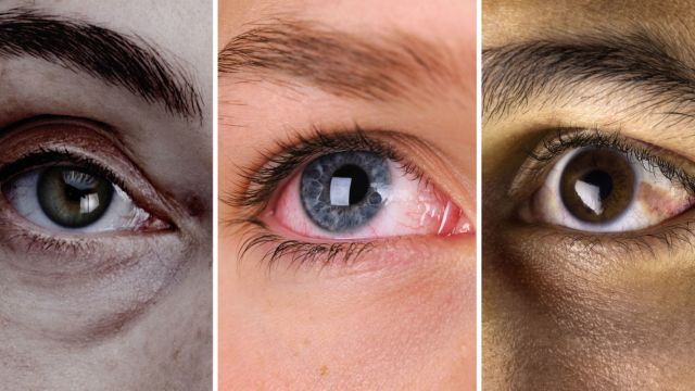 9 Signs Your Eyes Are Telling You About Your Health Here's What to Look for