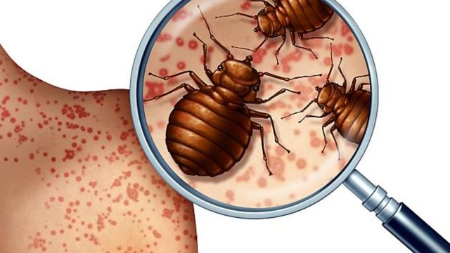 Bed Bug Crisis in Pennsylvania How 5 Cities Are Responding to the Invasion (1)