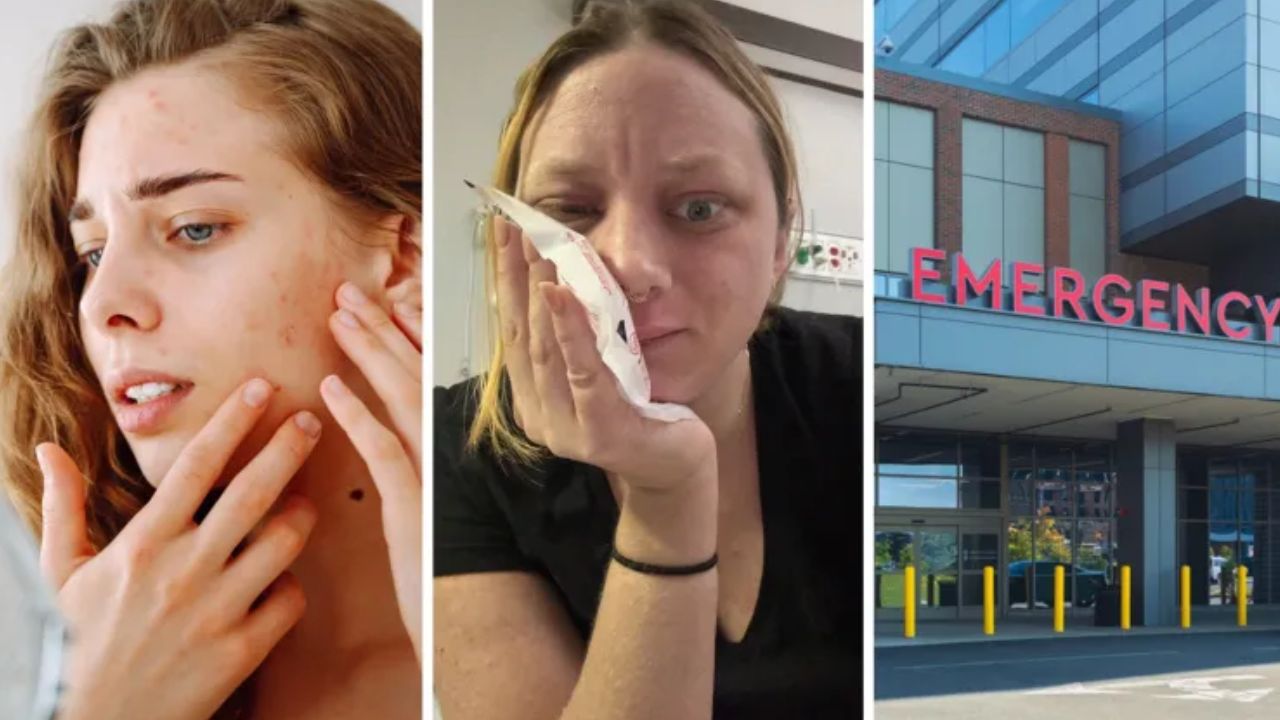 Louisiana Bartender Hospitalized After ‘Tiny Pimple’ Turns Into a Life-Threatening Infection